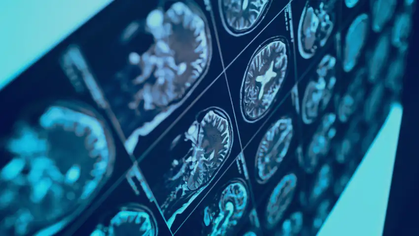 Latest Innovations in Medical Imaging